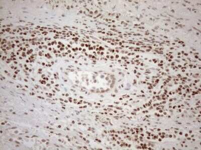 Immunohistochemistry: MGMT Antibody (OTI4F9) [NBP2-45843]