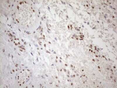 Immunohistochemistry: MGMT Antibody (OTI4F9) [NBP2-45843]