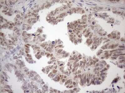 Immunohistochemistry: MGMT Antibody (OTI4F9) [NBP2-45843]