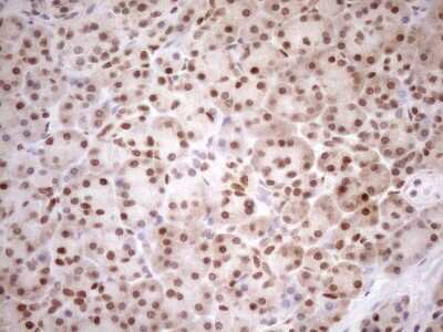 Immunohistochemistry: MGMT Antibody (OTI4F9) [NBP2-45843]
