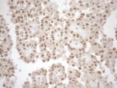 Immunohistochemistry: MGMT Antibody (OTI4F9) [NBP2-45843]