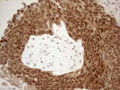 Immunohistochemistry: MGMT Antibody (OTI4F9) [NBP2-45843]
