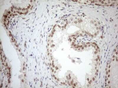 Immunohistochemistry: MGMT Antibody (OTI4F9) [NBP2-45843]