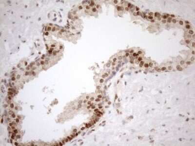 Immunohistochemistry: MGMT Antibody (OTI4F9) [NBP2-45843]
