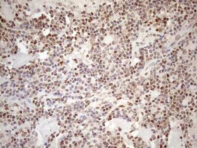 Immunohistochemistry: MGMT Antibody (OTI4F9) [NBP2-45843]