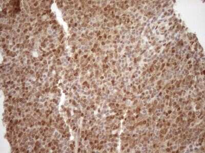 Immunohistochemistry: MGMT Antibody (OTI4F9) [NBP2-45843]