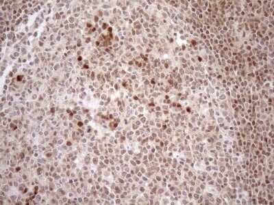 Immunohistochemistry: MGMT Antibody (OTI4F9) [NBP2-45843]
