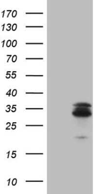 Western Blot: MGMT Antibody (OTI4F9) [NBP2-45843]