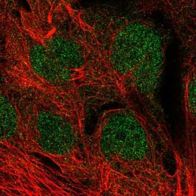 Immunocytochemistry/ Immunofluorescence: MGMT Antibody [NBP2-58611]