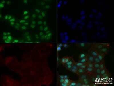 Immunocytochemistry/ Immunofluorescence: MGMT Antibody (MT 23.2) - Azide and BSA Free [NBP2-80847]