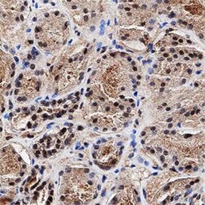 Immunohistochemistry-Paraffin: MGMT Antibody (MT 23.2) - Azide and BSA Free [NBP2-80847]