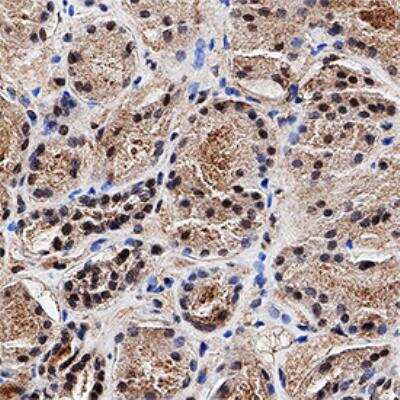 Immunohistochemistry-Paraffin: MGMT Antibody (MT 23.2) - BSA Free [NB100-168]