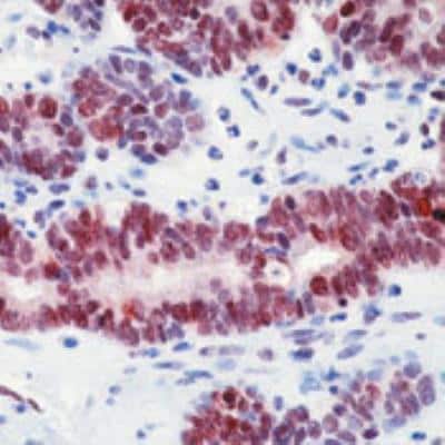 Immunohistochemistry-Paraffin: MGMT Antibody (MT 3.1) [NB100-692]