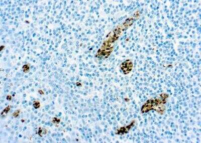 Immunohistochemistry-Paraffin: MGMT Antibody (MT 3.1) [NB100-692]