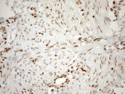 Immunohistochemistry: MGMT Antibody (OTI4F9) [NBP2-45843]