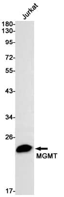 Western Blot: MGMT Antibody (S01-8B1) [NBP3-19480]