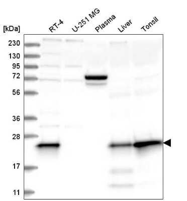 Western Blot: MGMT Antibody [NBP2-58612]