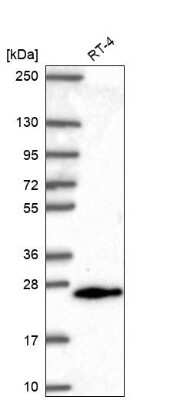 Western Blot: MGMT Antibody [NBP2-68885]