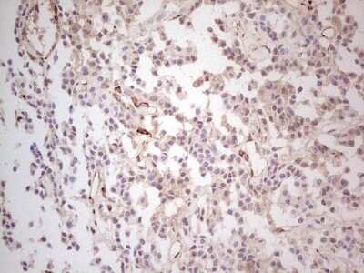 Immunohistochemistry: MGP Antibody (OTI11G6) [NBP2-45844]