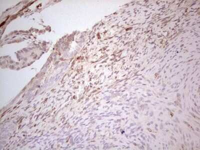 Immunohistochemistry: MGP Antibody (OTI11G6) [NBP2-45844]