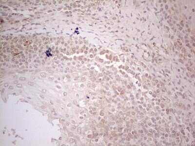 Immunohistochemistry: MGP Antibody (OTI11G6) [NBP2-45844]