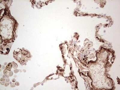 Immunohistochemistry: MGP Antibody (OTI11G6) [NBP2-45844]