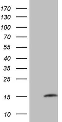 Western Blot: MGP Antibody (OTI11G6) [NBP2-45844]