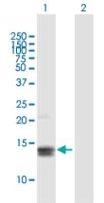 Western Blot: MGP Antibody [H00004256-B01P]