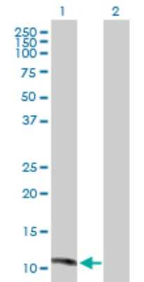 Western Blot: MGP Antibody [H00004256-D01P]