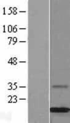 Western Blot: MGP Overexpression Lysate [NBL1-13091]