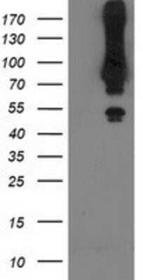 Western Blot: MGRN1 Antibody (OTI3C3) [NBP2-00586]