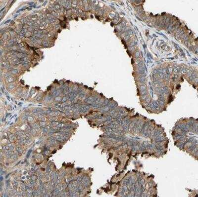 Immunohistochemistry-Paraffin: MGRN1 Antibody [NBP1-82998]