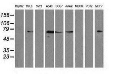 Western Blot: MGRN1 Antibody (OTI3C3)Azide and BSA Free [NBP2-72665]
