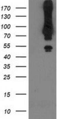 Western Blot: MGRN1 Antibody (OTI3C3)Azide and BSA Free [NBP2-72665]