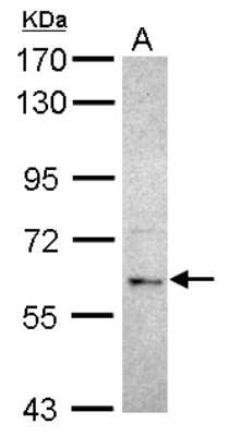 Western Blot: MGRN1 Antibody [NBP2-17286]