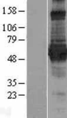 Western Blot: MGRN1 Overexpression Lysate [NBL1-13092]