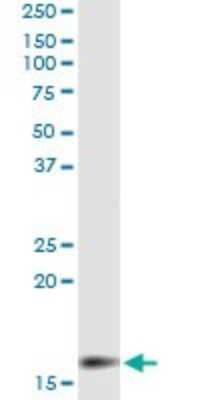 Immunoprecipitation: MGST2 Antibody (4E1) [H00004258-M04]