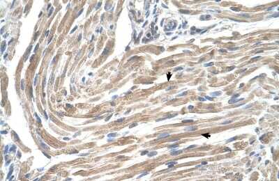 Immunohistochemistry-Paraffin: MGST2 Antibody [NBP1-59066]