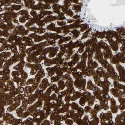 Immunohistochemistry-Paraffin: MGST2 Antibody [NBP1-82653]