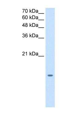 Western Blot: MGST2 Antibody [NBP1-59066]