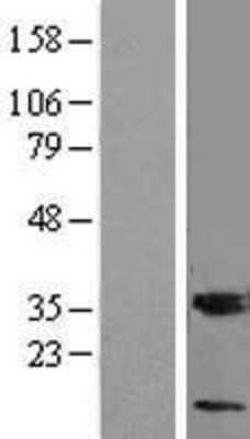 Western Blot: MGST3 Overexpression Lysate [NBL1-13095]