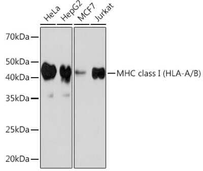 Western Blot: MHC Class I Antibody (3I1C1) [NBP3-16696]