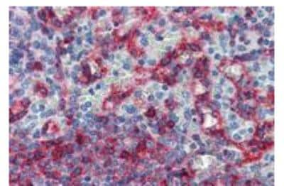 Immunohistochemistry: MHC Class I Antibody (MEM-E/06) - BSA Free [NB500-307]