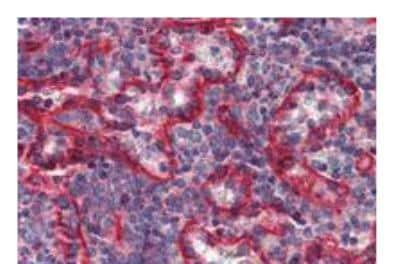 Immunohistochemistry: HLA-E Antibody (MEM-E/07) - BSA Free [NB500-310]