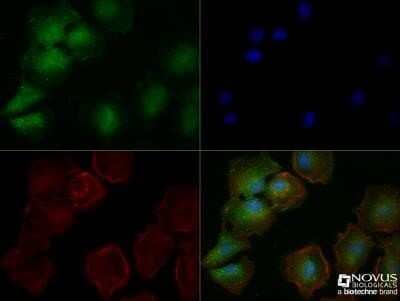 Immunocytochemistry/ Immunofluorescence: MHC Class I Antibody (OX18) - Azide and BSA Free [NBP2-80848]