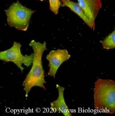 Immunocytochemistry/ Immunofluorescence: MHC Class I Antibody (OX18) - Azide and BSA Free [NBP2-80848]