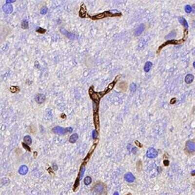 Immunohistochemistry: MHC Class I Antibody (OX18) - Azide and BSA Free [NBP2-80848]