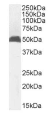 Western Blot: MHC Class I Antibody (R1-21.2)ChimericAzide and BSA Free [NBP3-09017]