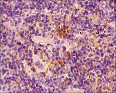 Immunocytochemistry: MHC Class II RT1B Antibody (OX-6) - Azide and BSA Free [NBP2-80849]