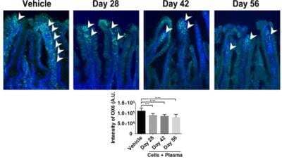 Immunohistochemistry: MHC Class II RT1B Antibody (OX-6) - BSA Free [NB100-65541]